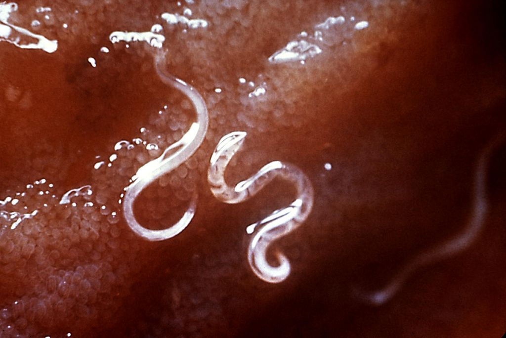 Phylum Nematoda - Roundworm