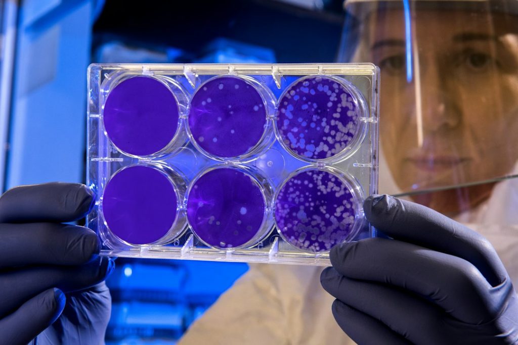 A scientist wearing protective gear and gloves holds up a clear tray with six purple-stained petri dishes showing bacterial or cell cultures. The background has a blue laboratory setting.